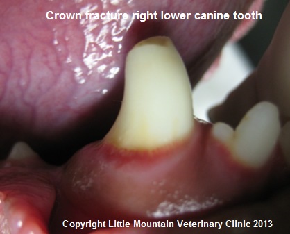 right-lower-canine-tooth-ccf